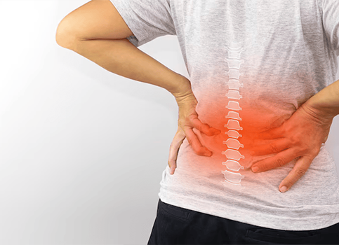 lumbar-Spondylosis